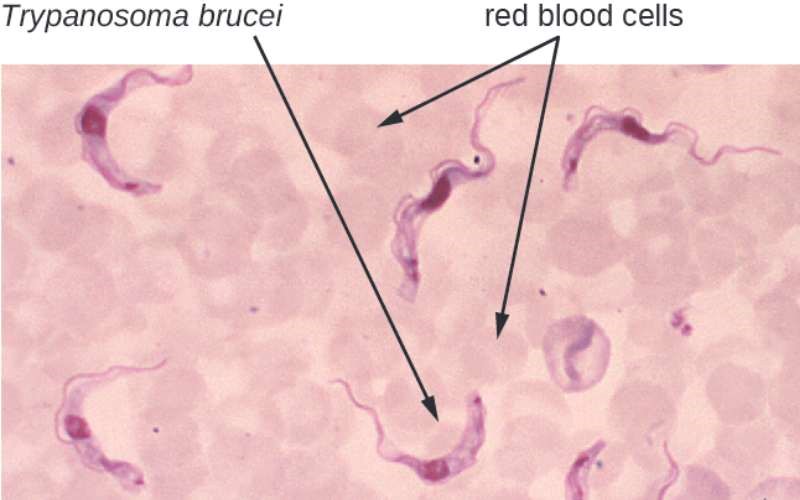 نمایی از انگل بیماری خواب