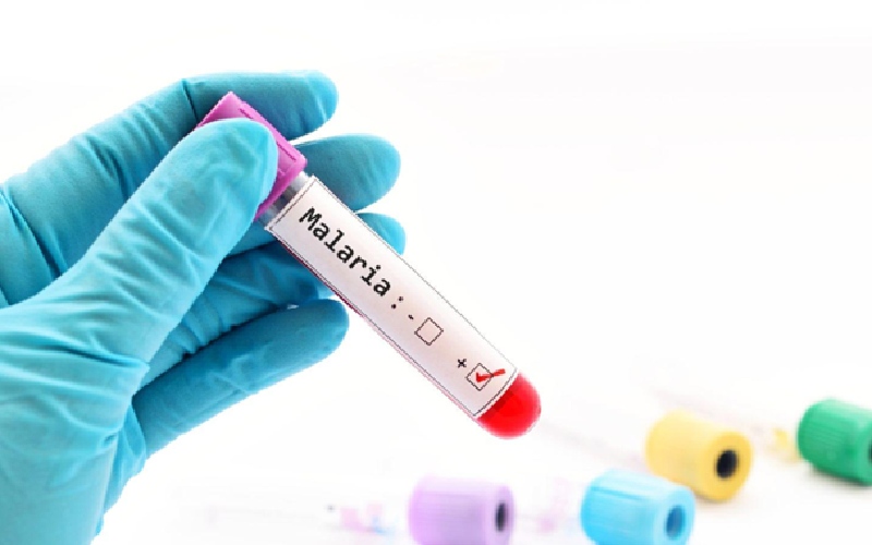 علائم مالاریا در بدن