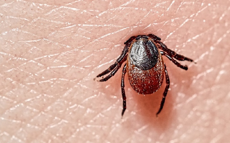 چگونه کنه را از روی پوست جدا کنیم