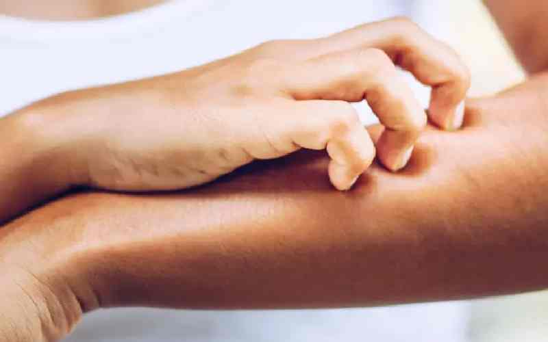 محرک‌های روزمره خارش پوست