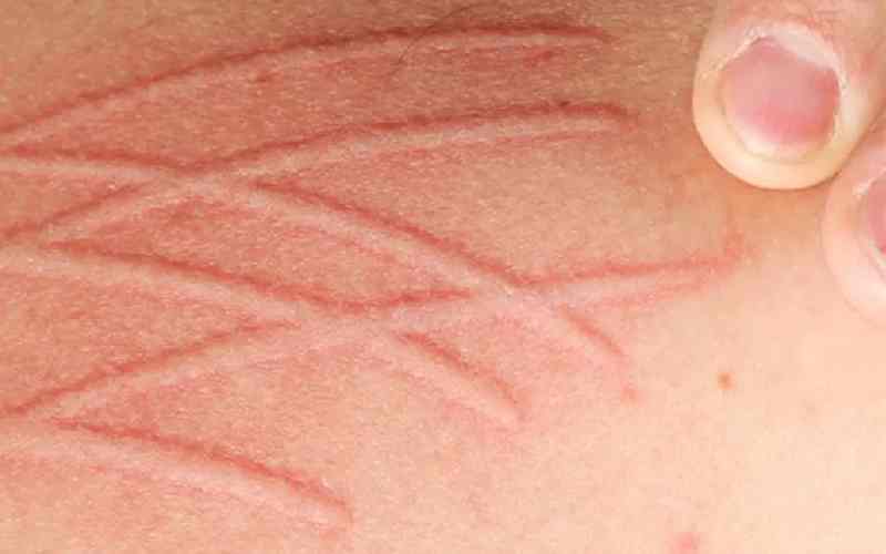 واکنش بدن به عوامل حساسیت‌زا