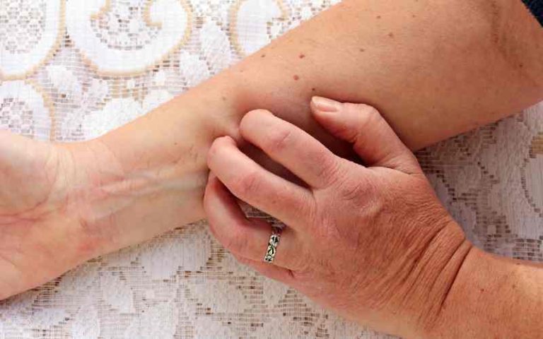 علت خارش بدن؛ چرا پوست ما دچار خارش می‌شود؟