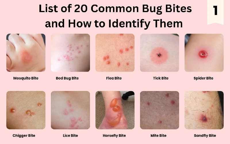 انواع نیش حشرات با عکس