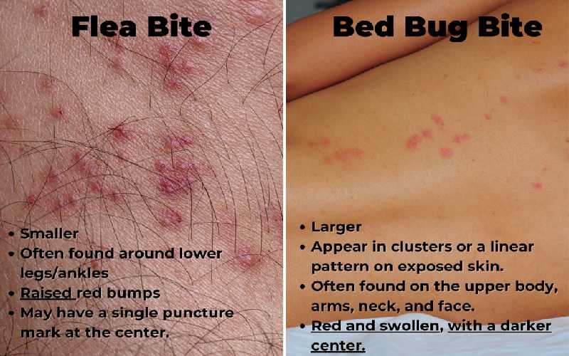 روش‌های درمان گزش ساس و کک