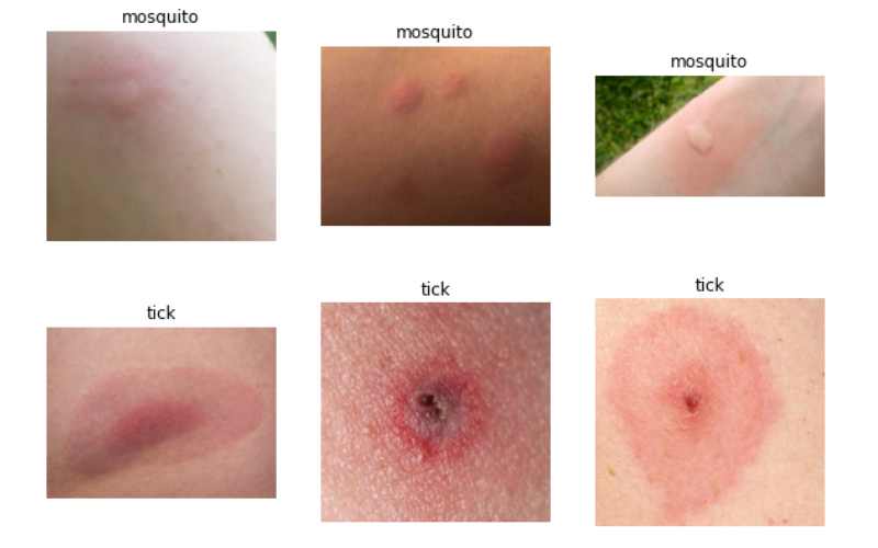 انواع نیش حشرات روی صورت