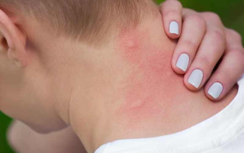 نیش حشراتی که نیش نمی‌زنند