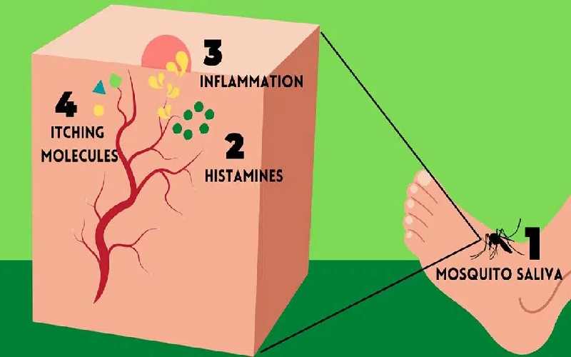 نیش زدن پشه