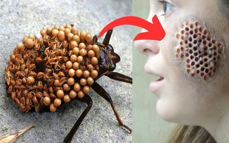عجیب ترین حشرات خطرناک