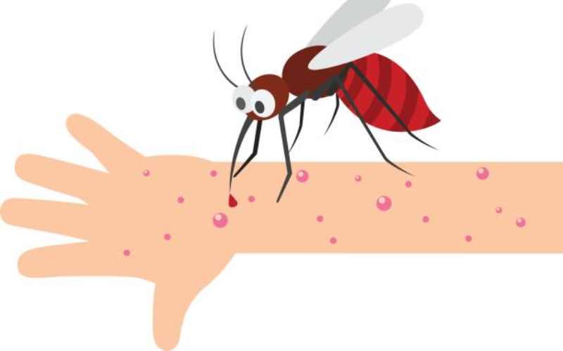 جای نیش پشه